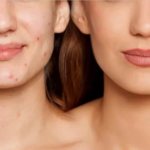 Cover all foundations