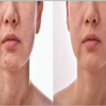 About-Before and after3